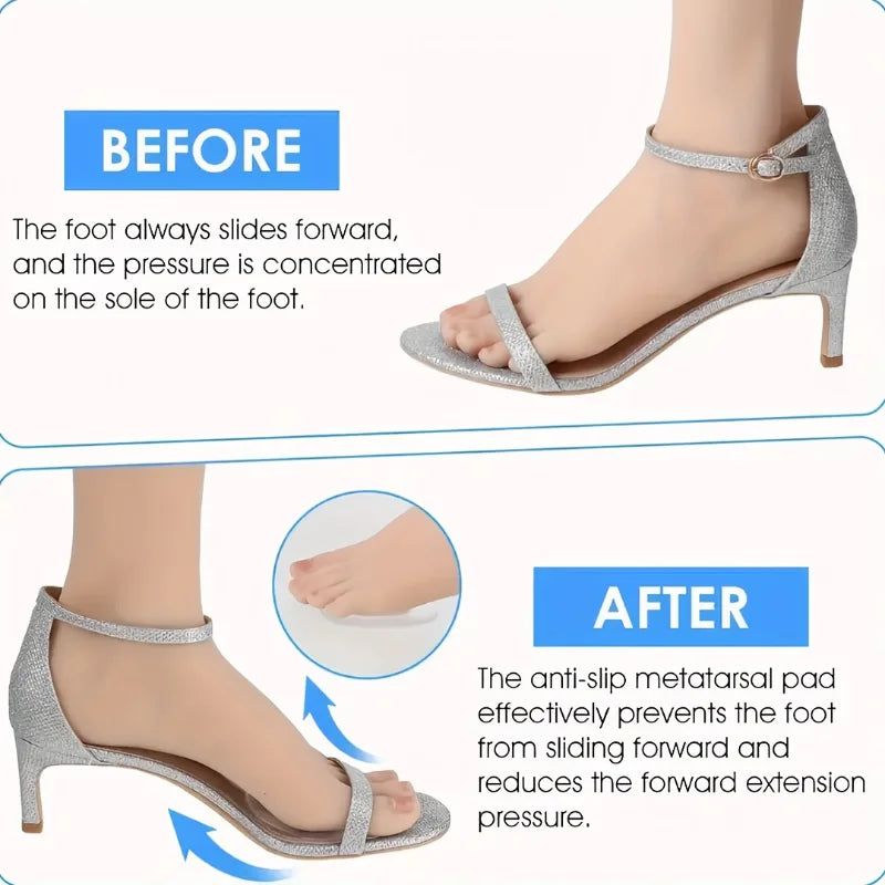 Before and after comparison showing an anti-slip metatarsal pad in a silver shoe for foot comfort
