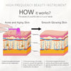 Diagram showing how a high frequency beauty instrument works to treat acne and aging skin by stimulating cellular activity an