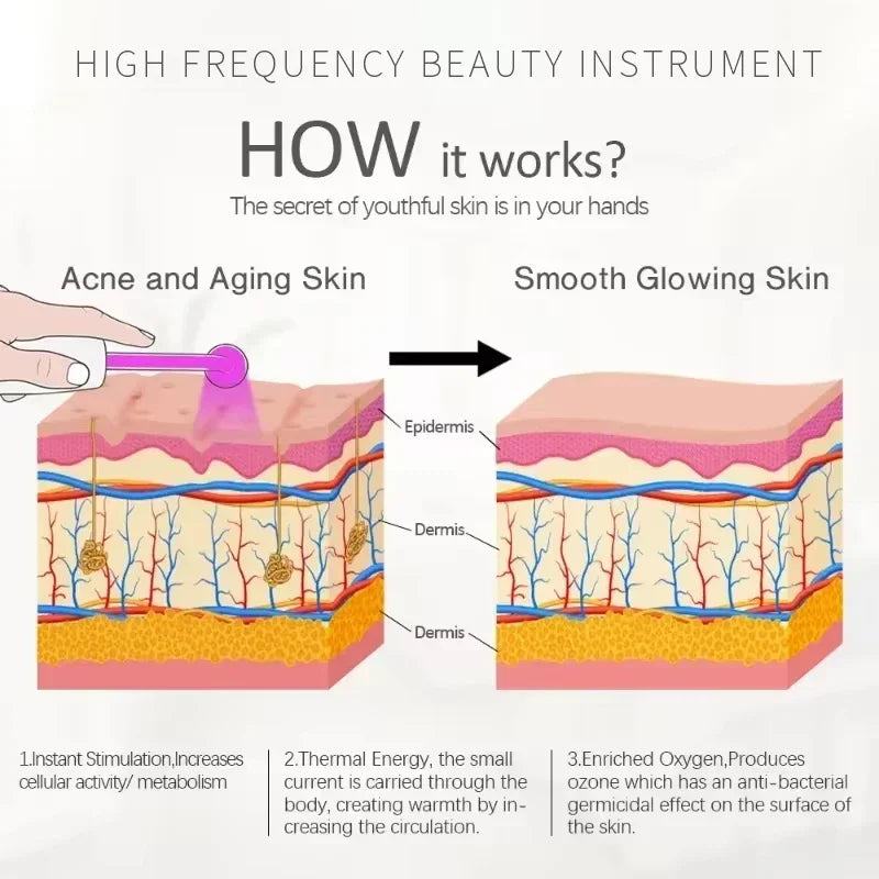 Diagram showing how a high frequency beauty instrument works to treat acne and aging skin by stimulating cellular activity an