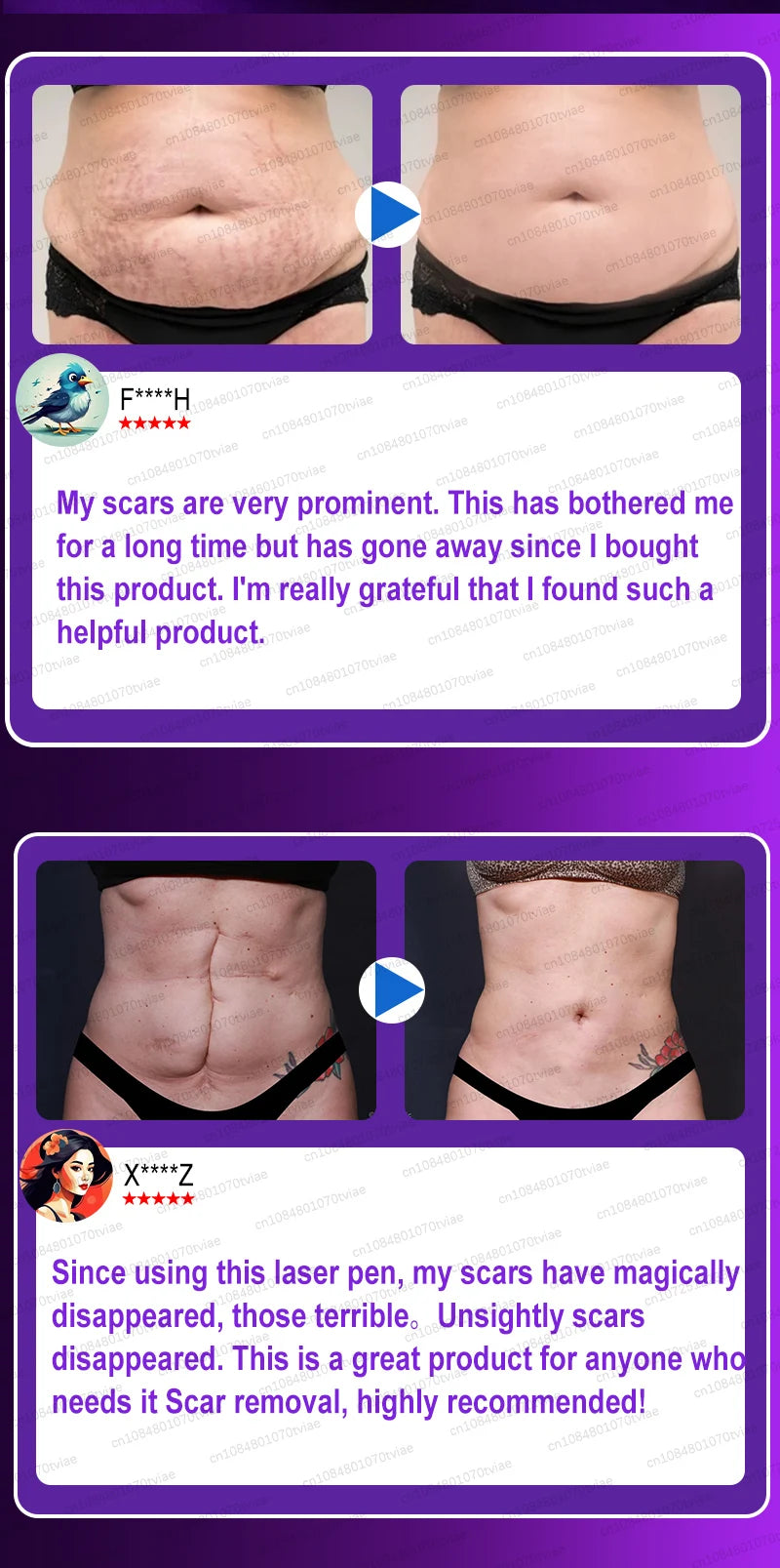 A before and after comparison showing scars disappearing after using a laser pen treatment.