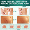 Before and after images showing the use of medical grade silicone rolls for scar treatment, demonstrating repair damage, wet 