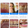 A set of dental cleaning tools for removing tartar, plaque, bad breath, tooth discoloration, and stains from teeth.