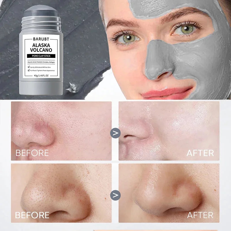 A stick of Barubt Alaska Volcano Pore Clay Stick is shown next to a woman's face before and after treatment.