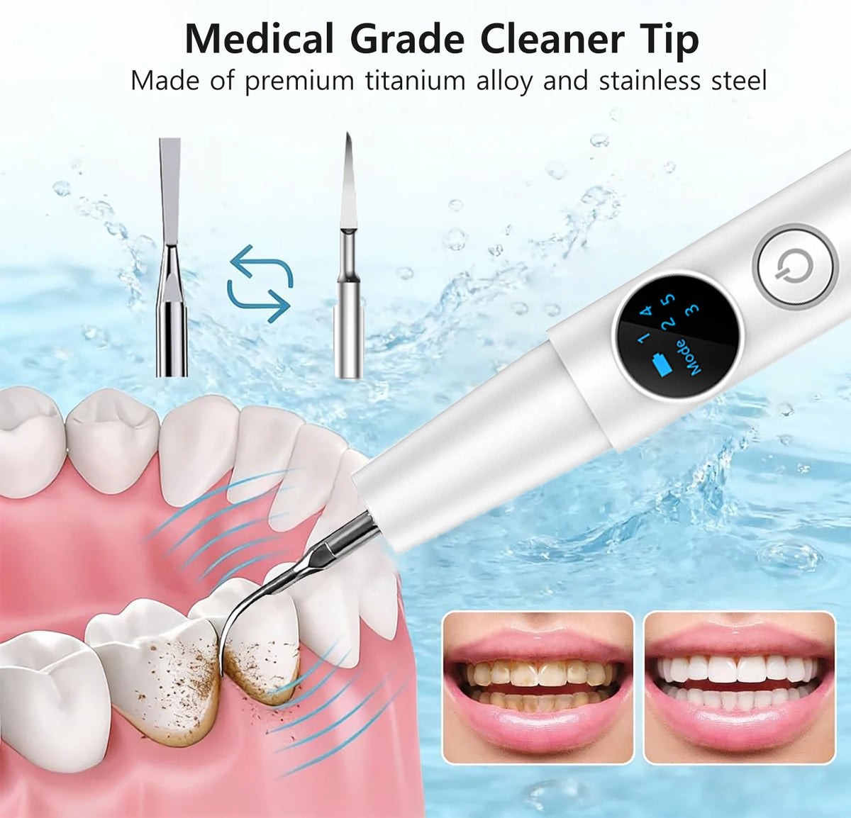 A medical grade titanium and stainless steel ultrasonic dental cleaning tip being used on a tooth, with close-ups of the clea