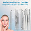 Professionelles Edelstahl-Beauty-Werkzeugset für Pickel, Komedonen und Fettgranula neben einem Gesichts.