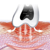 A close-up of a microcurrent facial massager device positioned on the skin, demonstrating its use for promoting import and mo