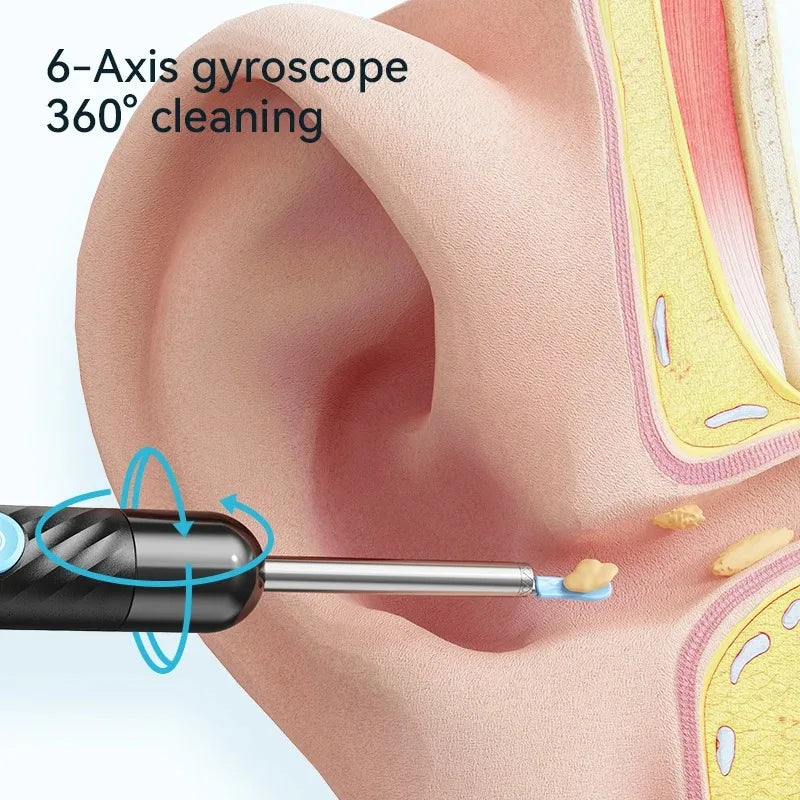 A medical device is shown using a 6-axis gyroscope for 360 degree cleaning on the ear.