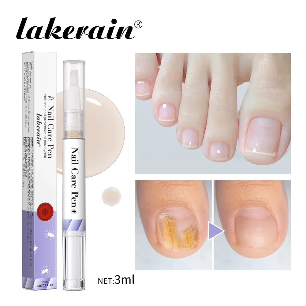 Flasche Lakerain Nagelhautpflege mit klarem Applikator und Nagelhautspitzen für tiefe Feuchtigkeitspflege