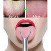 Stainless steel tongue scraper shown in a close-up of the mouth, demonstrating before and after use.