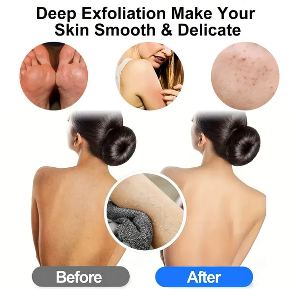 Before and after images showing the effect of a deep exfoliation treatment on skin smoothness.