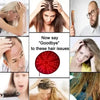 A collage showing various hair issues and people experiencing them, related to a red light therapy cap for hair growth and lo