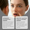 Close-up of a woman's face showing skin texture and pores, with text describing upgraded technology and multiple suction leve
