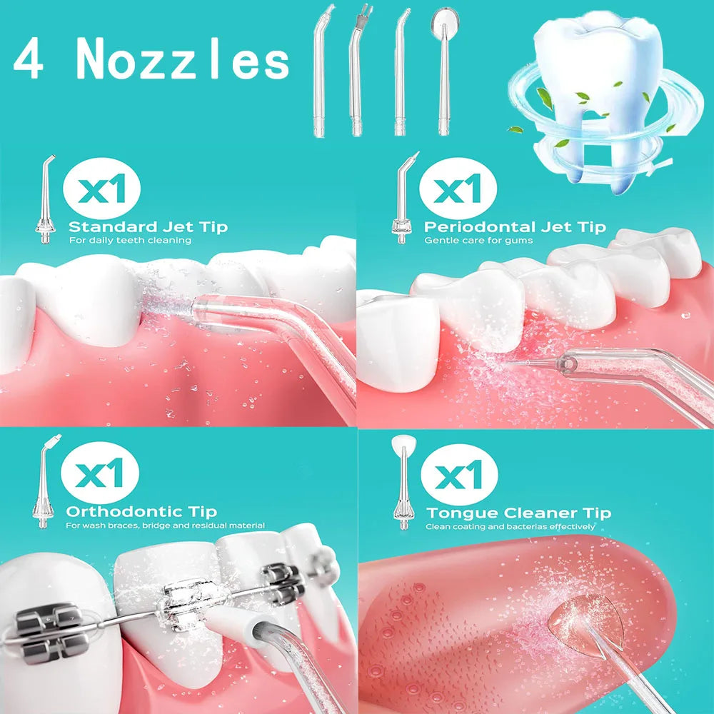A collection of four dental tips including a standard jet tip, periodontal jet tip, orthodontic tip, and tongue cleaner tip f