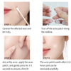 Guide étape par étape montrant comment utiliser des patchs d'acné hydrocolloïdes pour traiter les imperfections.
