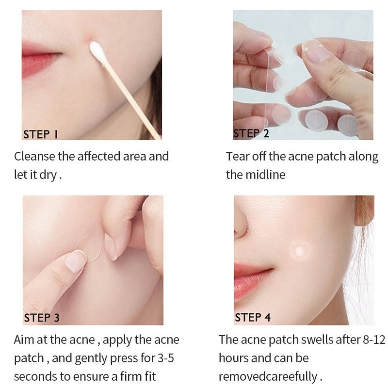 Guide étape par étape montrant comment utiliser des patchs d'acné hydrocolloïdes pour traiter les imperfections.