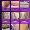A grid showing various types of scars including stretch marks, hyperplastic, and surgical scars.