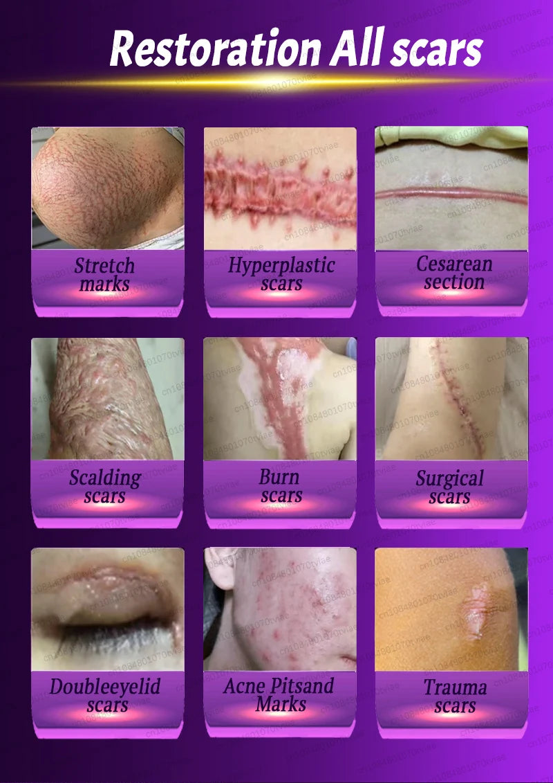 A grid showing various types of scars including stretch marks, hyperplastic, and surgical scars.
