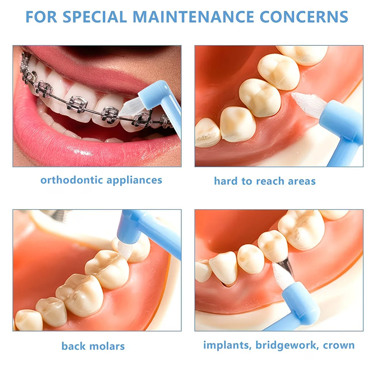 Images showing various dental procedures including orthodontic appliances, hard to reach areas, back molars, and implants, br