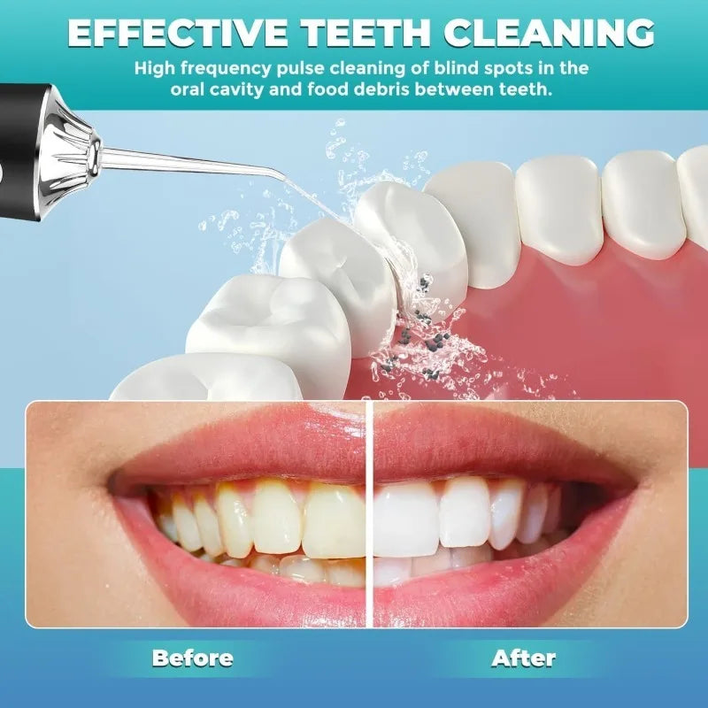 A dental water flosser is shown cleaning teeth and removing food debris between them, with before and after results displayed