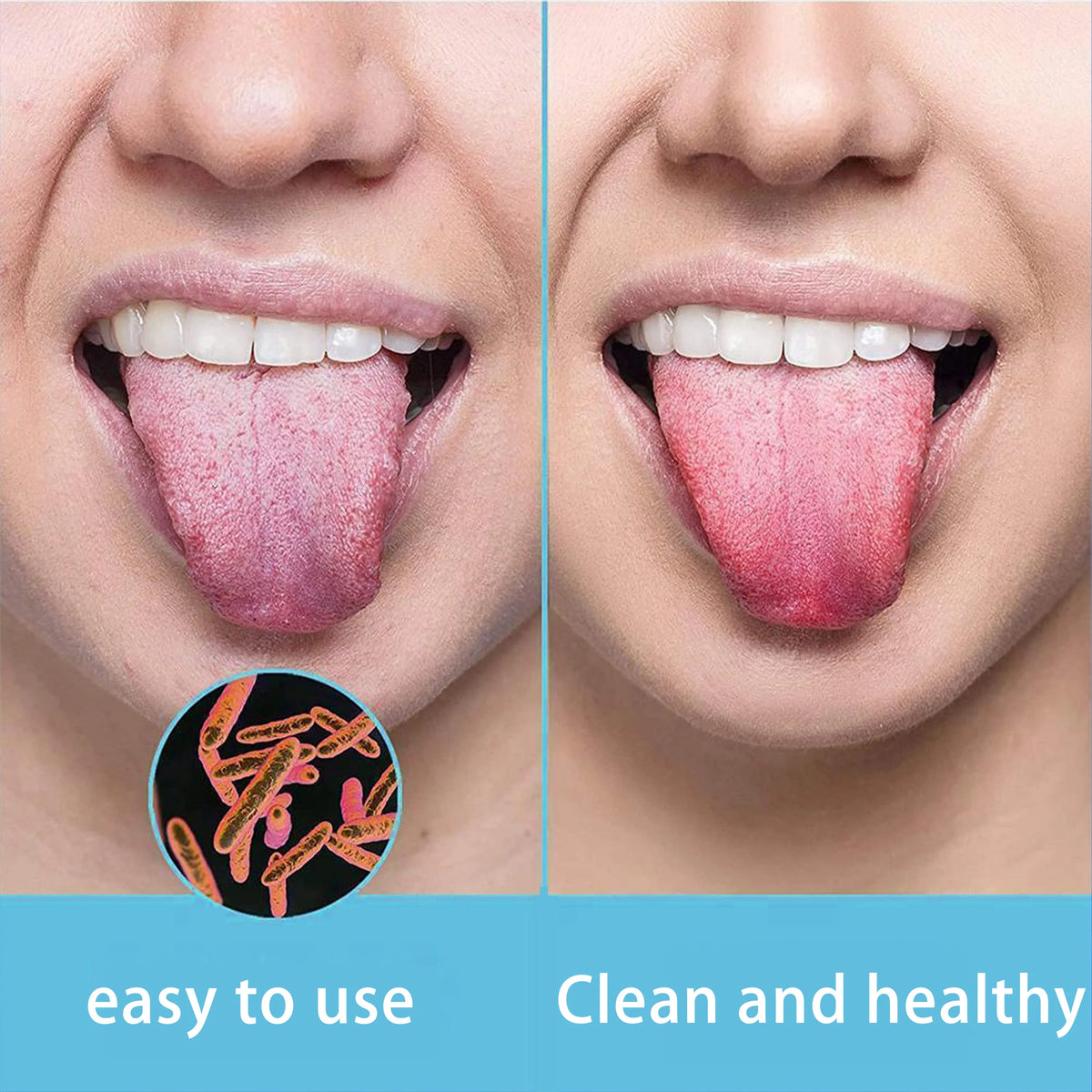 Close-up of a person using a stainless steel tongue and gum scraper set for oral hygiene.
