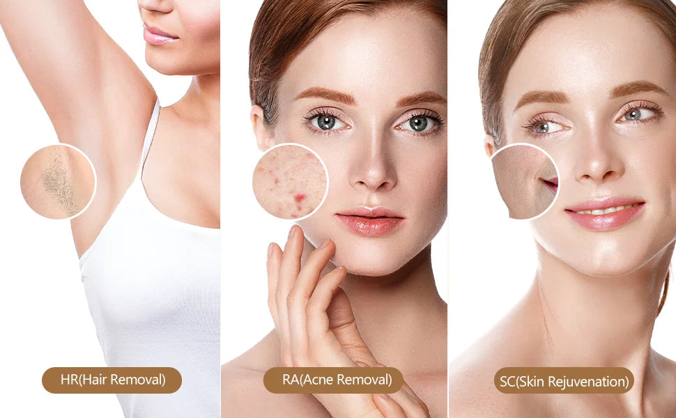 Close-up of a woman's skin showing results from HR (Hair Removal), RA (Acne Removal), and SC (Skin Rejuvenation) treatments.