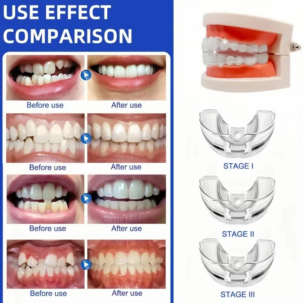 Demonstration of a silicone dental alignment trainer showing before and after use stages.