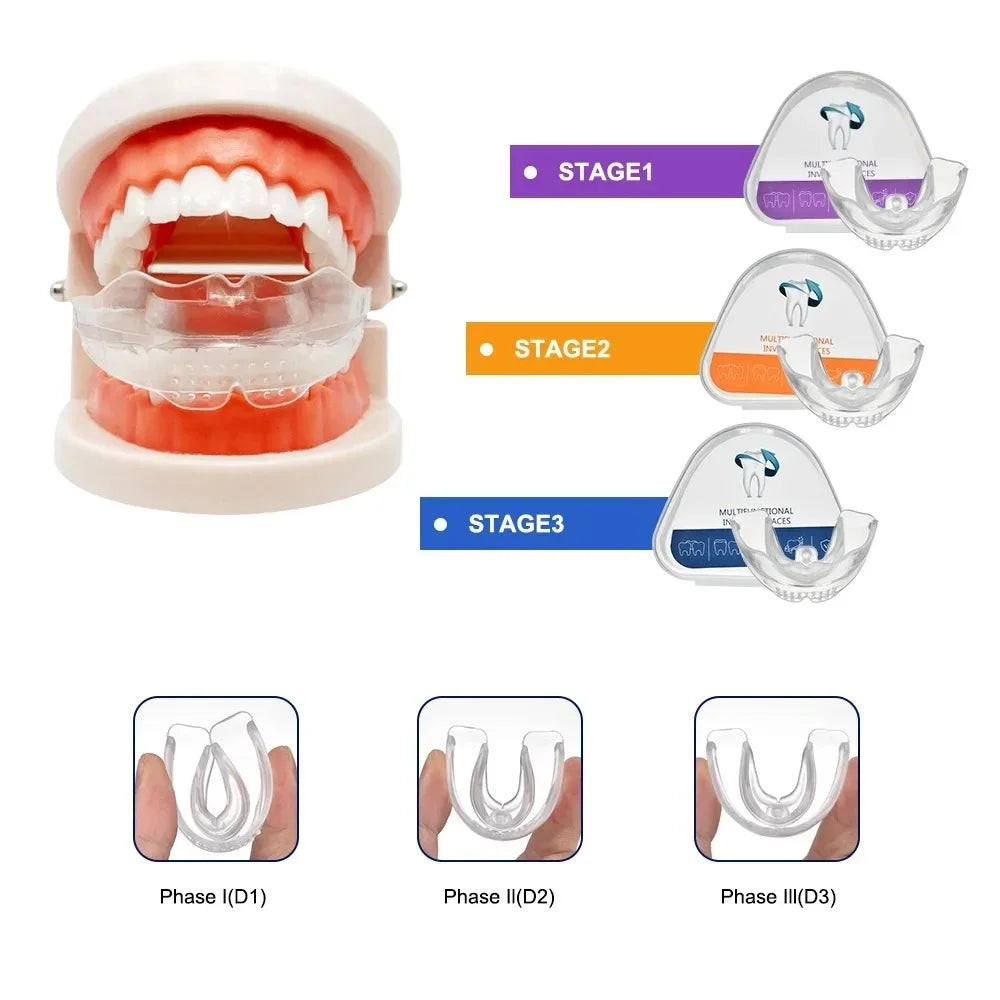 A set of silicone dental alignment trainers shown in three stages: Phase I, Phase II, and Phase III.