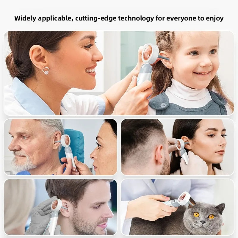 Various people using a portable HD ear camera for detailed inspection of ears.
