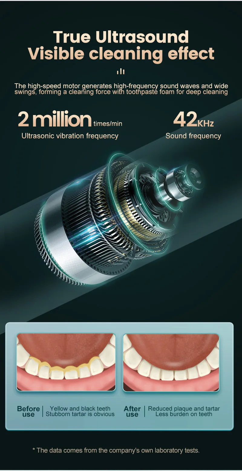 A close-up view of a professional ultrasonic dental tooth cleaner device with visible internal components.