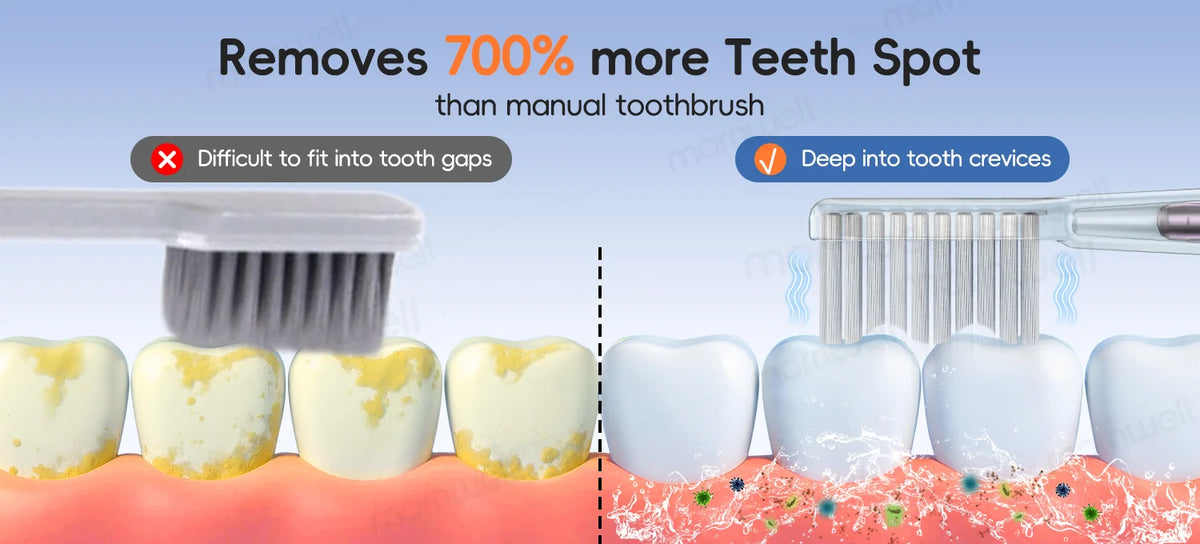 An electric water flosser cleaning teeth, demonstrating its ability to remove tooth spot and clean between teeth.