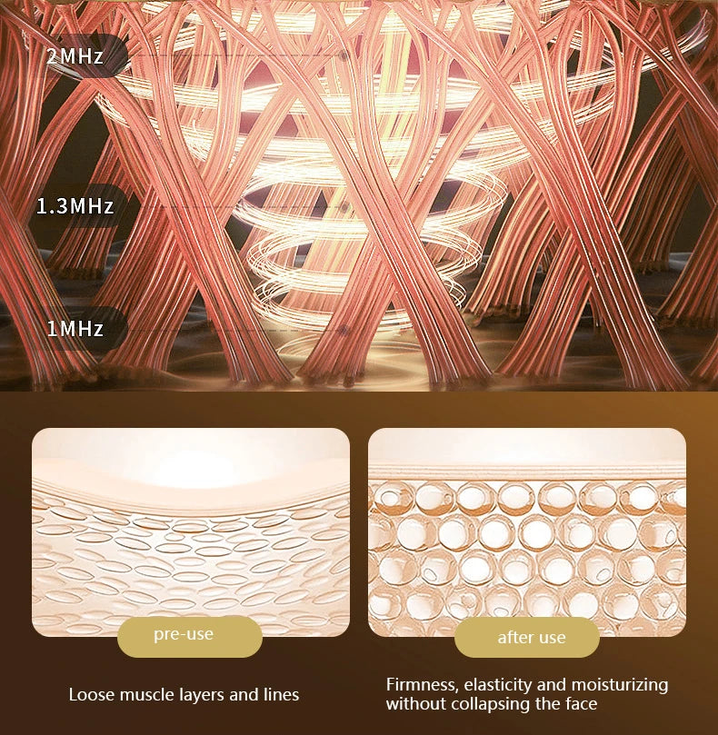 Close-up of an electric facial massager with multiple fine, flexible silicone lines and needles used for muscle lifting and f