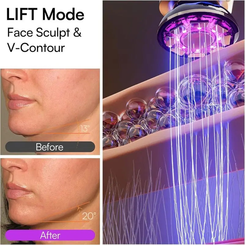 Before and after comparison of a facial sculpting device showing skin contouring results.