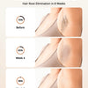 Before and after comparison showing hair root elimination results over 8 weeks with an IPL device.