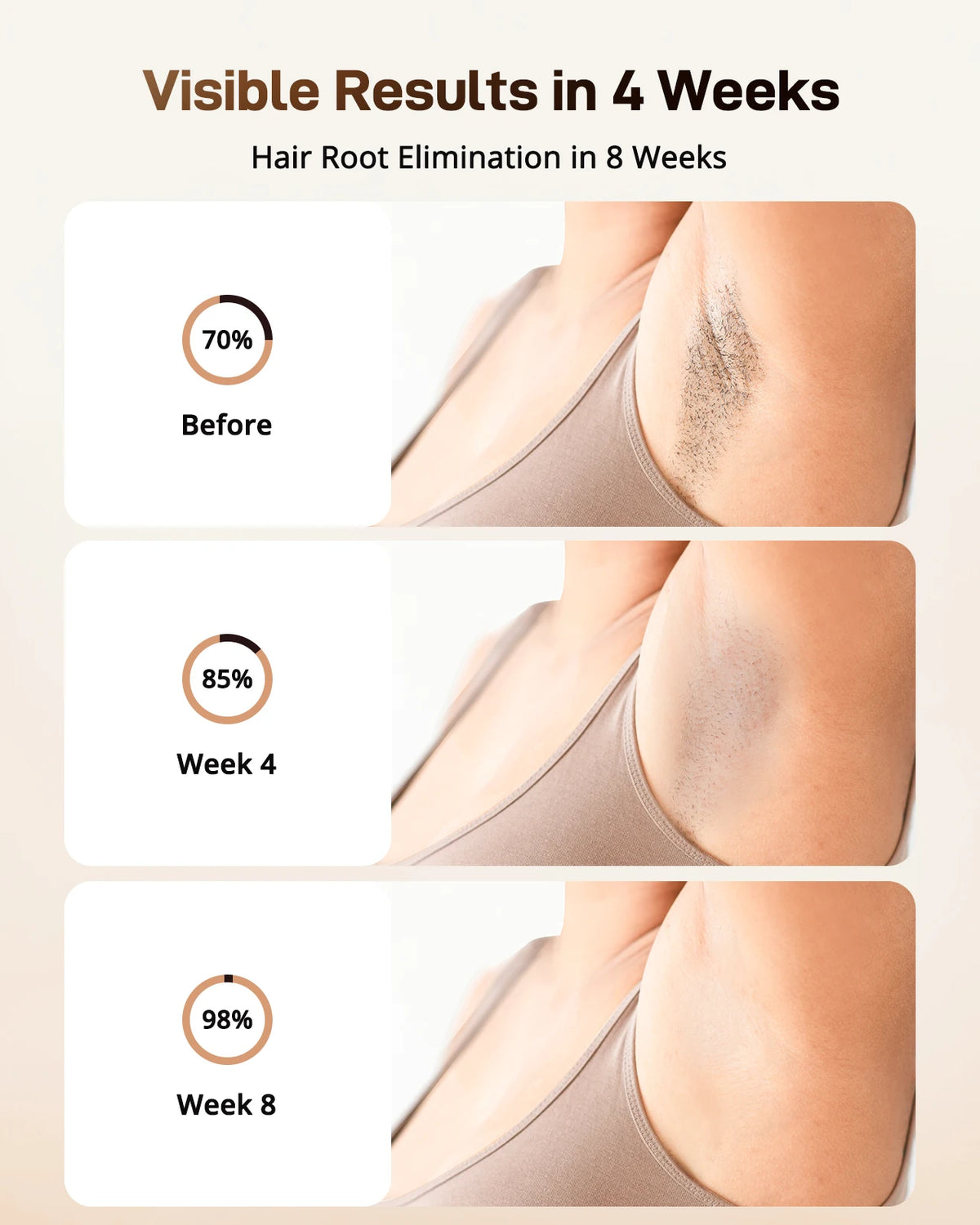 Before and after comparison showing hair root elimination results over 8 weeks with an IPL device.