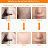 Before and after images showing skin rejuvenation results like pore invisibility, spot blotting, and acne disappearance.