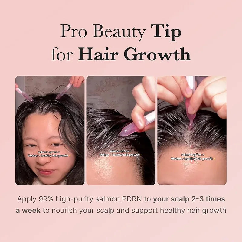 Hands apply a clear serum to a person's scalp for hair growth treatment.