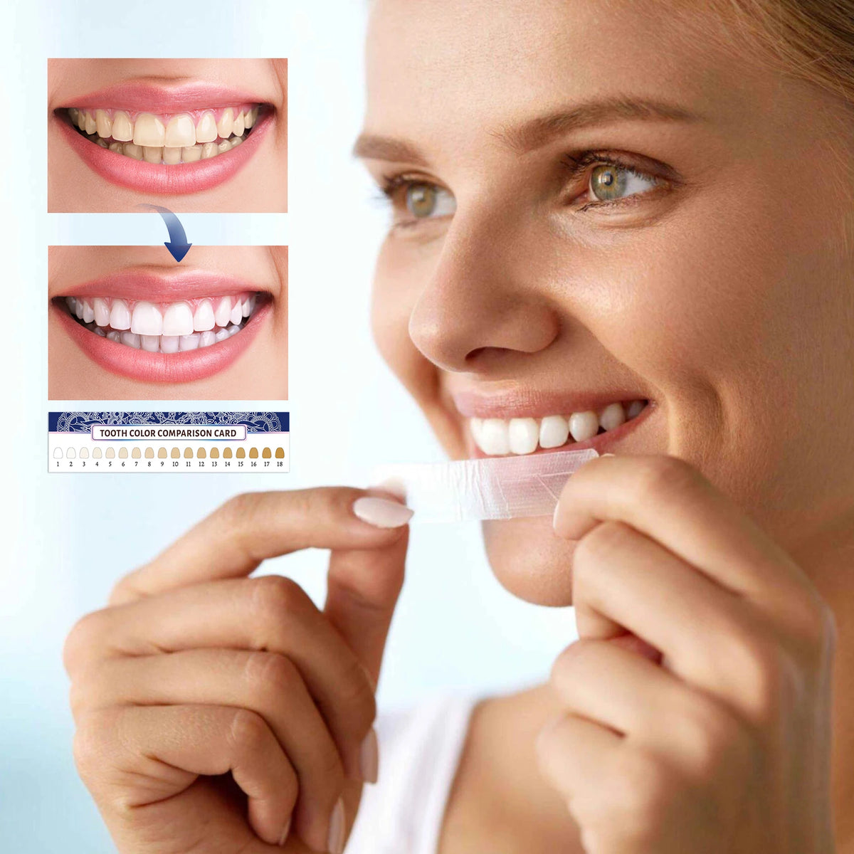 Una mujer muestra la comparación de dientes usando tiras blanqueadoras en su sonrisa.