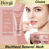 A tube of Homgyi Collagen Night Wrapping Mask is shown next to a woman applying it for blackhead removal.
