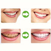Demonstration showing the proper fit and placement of silicone mouth guards for teeth protection on various facial angles.