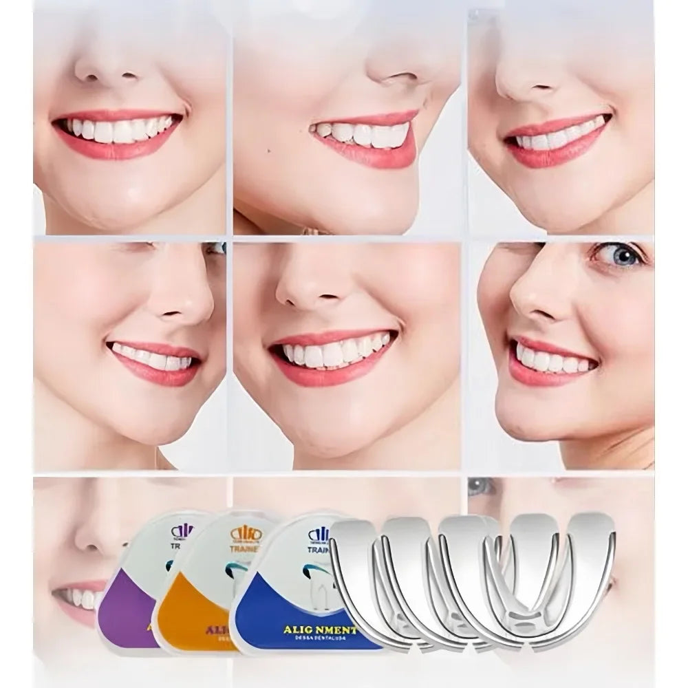 A set of silicone dental alignment trainers shown in various angles and on a model's face.