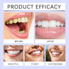 Before and after images showing the effect of gentle purple teeth whitening strips on teeth.