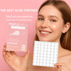 A woman is applying pimple patches on her skin, demonstrating the use of hydrocolloid acne spot patches.