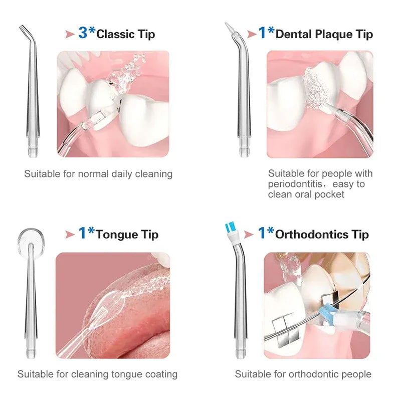 A set of three tips for an oral irrigator including a Classic Tip, Dental Plaque Tip, Tongue Tip, and Orthodontics Tip.