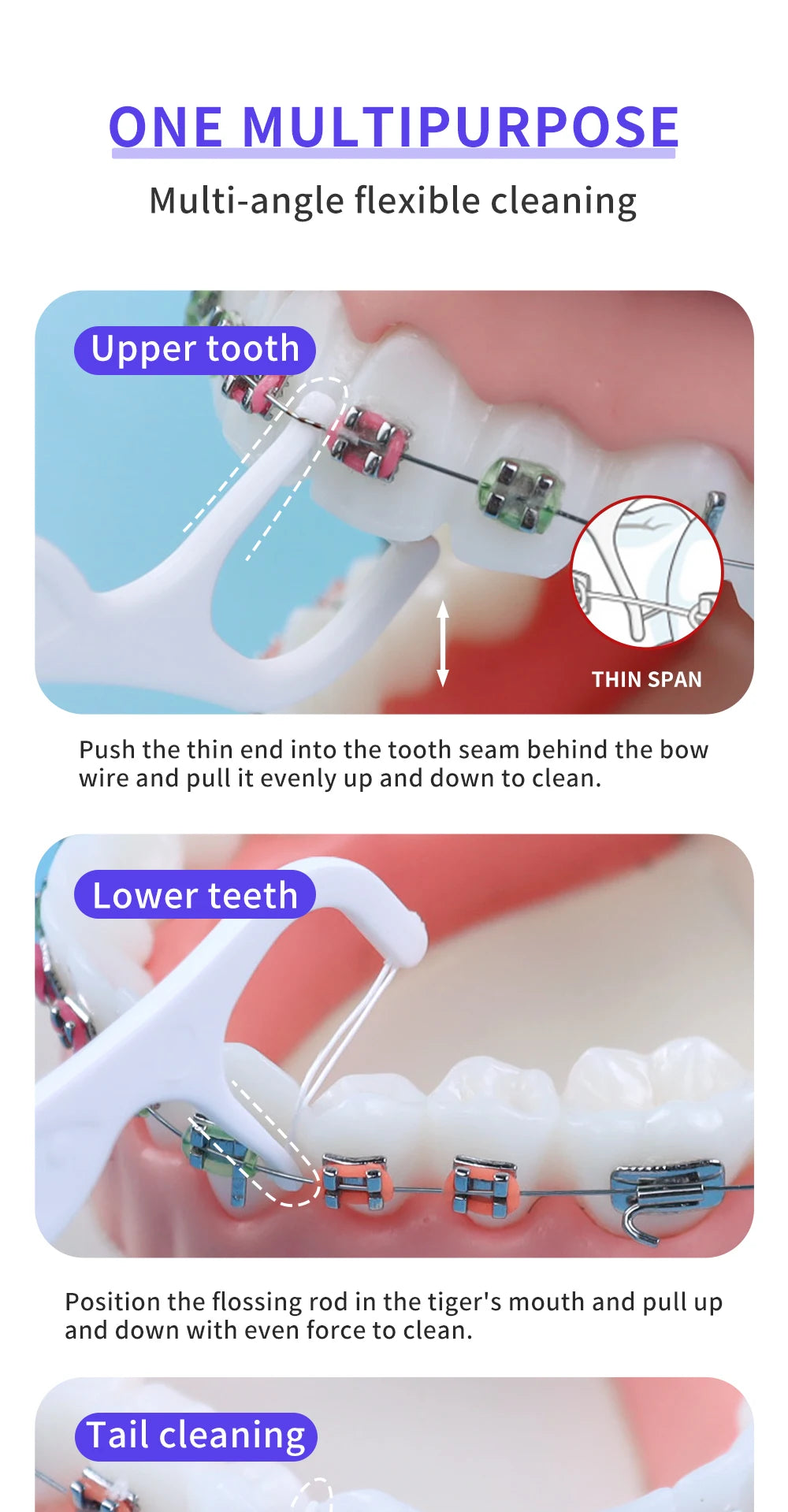 Demonstration of multi-angle flexible cleaning techniques for upper and lower teeth braces.