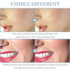 Close-up of skin and lips showing reduced pores and fine lines after facial rejuvenation treatment.