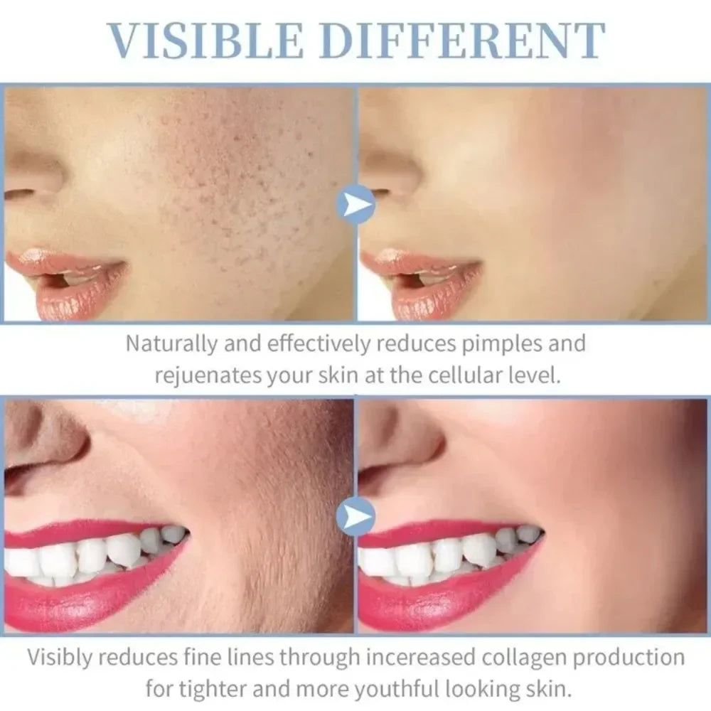 Close-up of skin and lips showing reduced pores and fine lines after facial rejuvenation treatment.