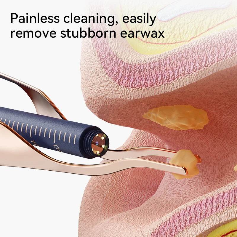 A close-up of an advanced ear cleaning kit being used to remove earwax from a person's ear.