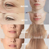 Before and after images showing the results of high frequency facial electrotherapy on skin and hair.