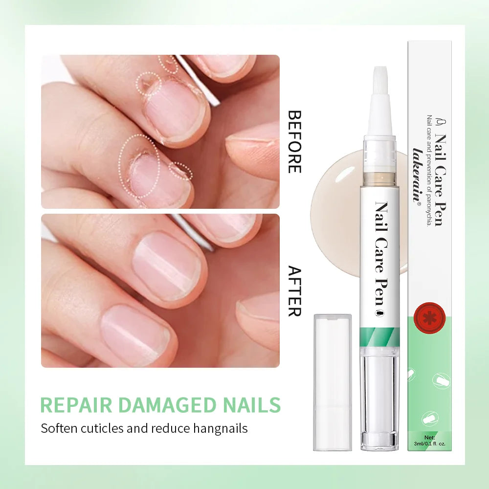 Vorher-Nachher-Bilder einer Nagelhautpflege-Feder zum Weichmachen von Cuticula und Hängenbleiben an Fingernägeln.
