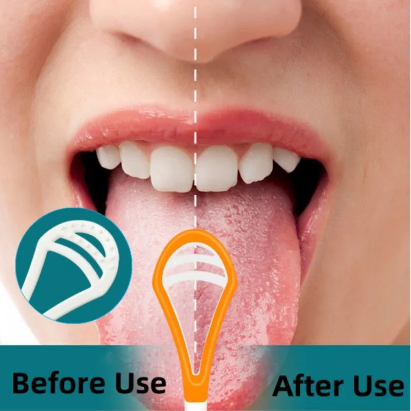 Comparaison avant/après d'un nettoyant pour la langue en silicone pour l'hygiène buccale